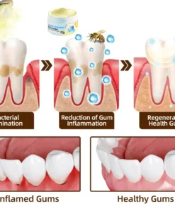 𝐎𝐲𝐢𝐤𝐞𝐲™ Focussmile Bee Venom Treatment Oral Powder