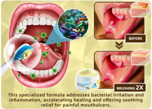 𝐎𝐲𝐢𝐤𝐞𝐲™ Focussmile Bee Venom Treatment Oral Powder