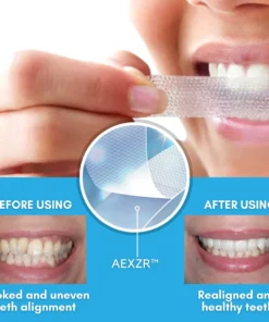 AEXZR™ Teeth Aligner Strips