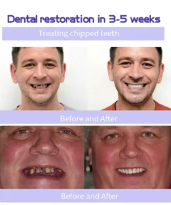 AEXZR™ Teeth Restoration Mineral Powder - UP TO 50% OFF