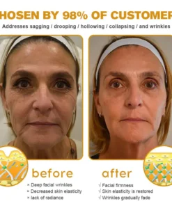 APKAPK™ Botox Bee Venom Wrinkle Removal Cream--Made and Shipped from the USA✅Last Day Promotion 80% OFF