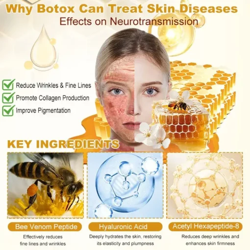 AllyBee™ Botox Bee Venom Wrinkle Removal Cream