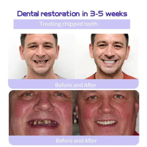 GarageLine™ Teeth Restoration Mineral Powder - Image 8