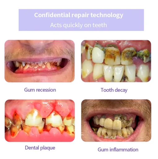 GarageLine™ Teeth Restoration Mineral Powder - Image 9