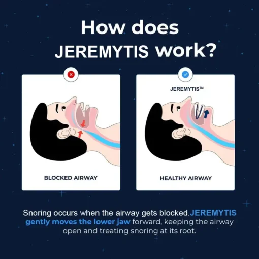 JEREMYTIS™ Adjustable Anti-Snoring Mouthpiece