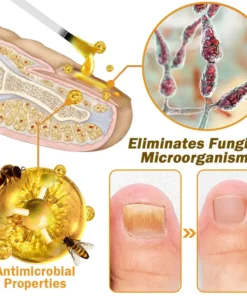 LOVILDS™ Nail Fungus Bee Poison Treatment Serum