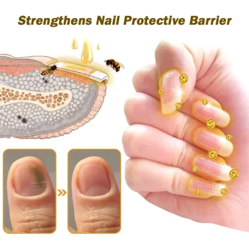 LOVILDS™ Nail Fungus Bee Poison Treatment Serum