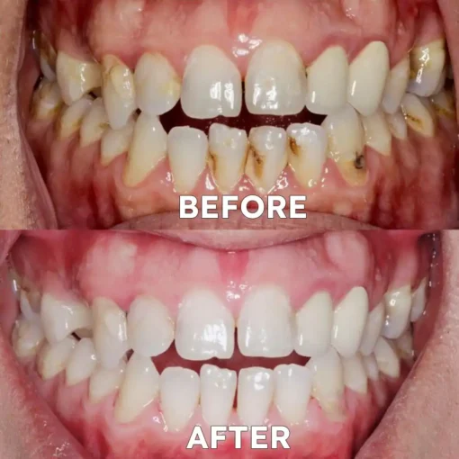 Ourlyard™ Tooth Health Mineral Powder - Image 5