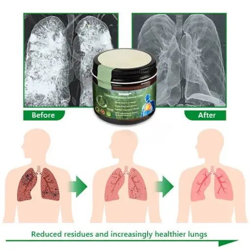 Raindew™ Mullein Clear Lung Repair Cream - Image 14