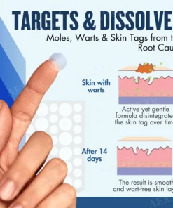 Skinetiv™ Moles & Warts Removing Skin Tag Patch